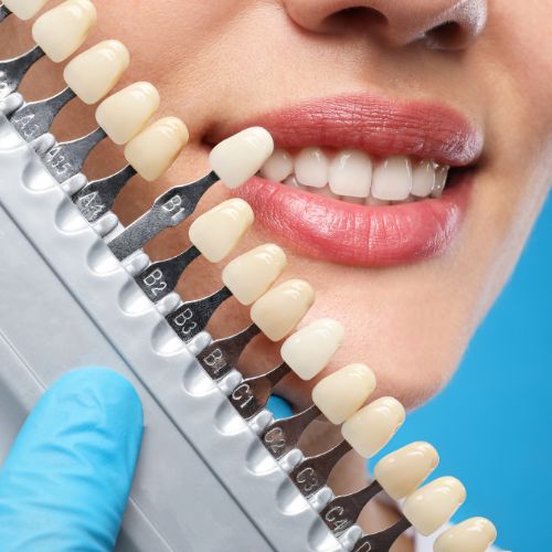 cosmetic-dentistry