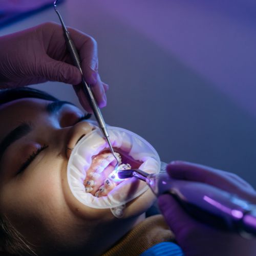 restorative-dentistry